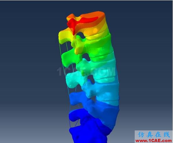 【醫(yī)學(xué)應(yīng)用】骨科知識和有限元分析ansys圖片3